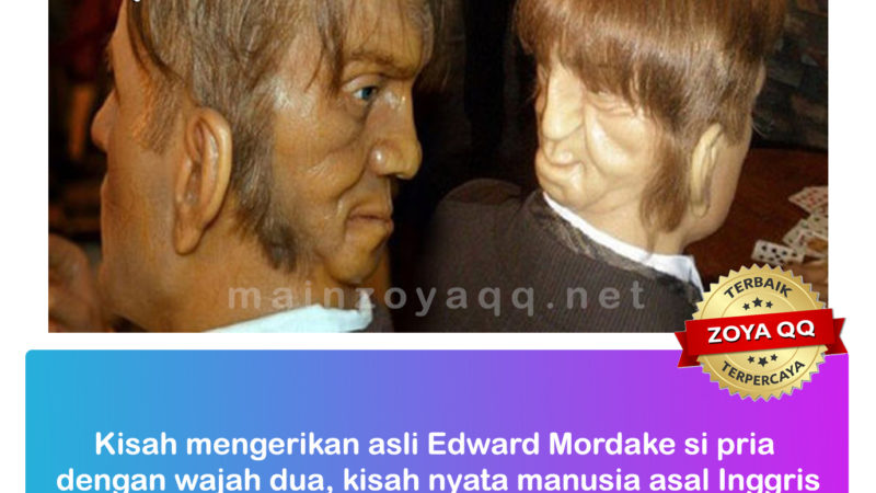 Kisah Nyata Edward Mordrake Pria Berwajah Dua