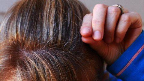6 Faktor yang Bikin Rambut Beruban di Usia Muda