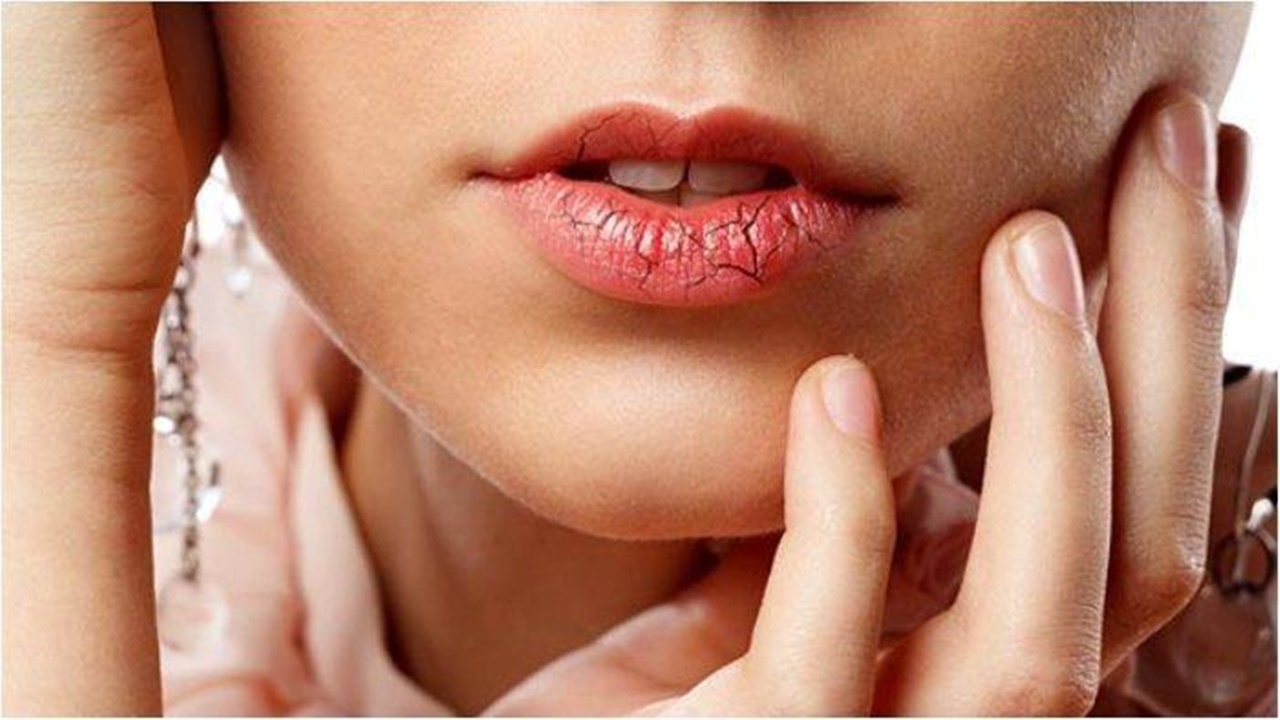 Ada 6 Cara Terbaik Atasi Bibir Kering dan Pecah-Pecah